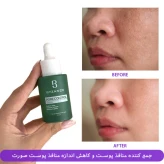 سرم ضدجوش و کوچک کننده منافذ بیزانس 2 سرم ضدجوش و کوچک کننده منافذ بیزانس